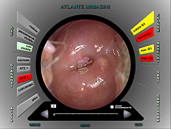 atlas of colposcopy images