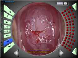 colposcopy d.i. test regione emilia romagna