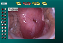 colposcopy interactive self-assesment