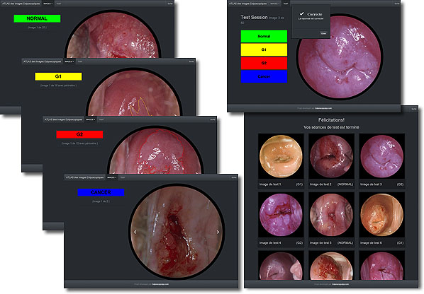 Atlas des Images Colposcopiques